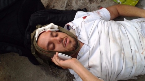 יהודי שנפצע בשכונת סילוואן בירושלים, השבוע (עמית אררט, סוכנות תצפית)