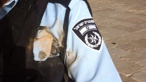 שוטר שנפגע זיקוק שירו ערבים בהר הבית (משטרה)